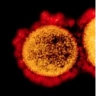 Severe Acute Respiratory Syndrome Coronavirus 2